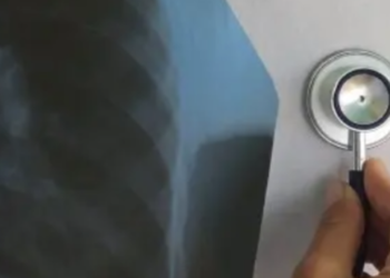 Київ під впливом небезпечних вірусів: динаміка захворюваності